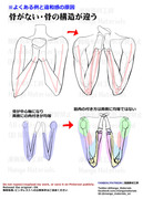 個人メモ：肘