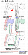 個人メモ：脚の構造と可動