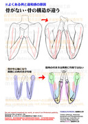 個人メモ：曲げた肘