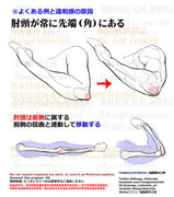 個人メモ：肘のよくある違和感