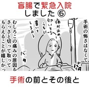 盲腸で緊急入院しました ⑥ 手術の前とその後と